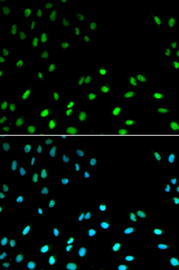 RFC1 Polyclonal Antibody (E-AB-60380)