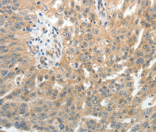 E-Selectin Polyclonal Antibody (E-AB-10570)