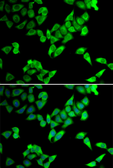 TRIP10 Polyclonal Antibody (E-AB-61483)