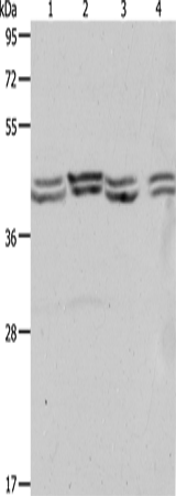 PSMD6 Polyclonal Antibody (E-AB-12849)
