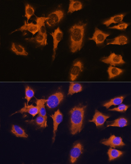 SLC20A1 Polyclonal Antibody (E-AB-63776)
