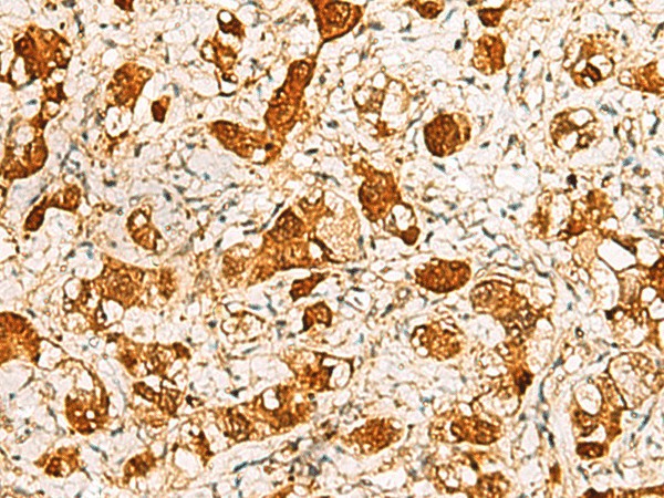 C11orf54 Polyclonal Antibody (E-AB-19208)