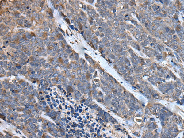 MCM10 Polyclonal Antibody (E-AB-52160)