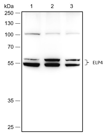 Recombinant ELP4 Monoclonal Antibody (AN301770L)