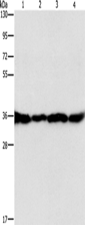 GNB1 Polyclonal Antibody (E-AB-14090)