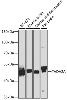 TADA2A Polyclonal Antibody (E-AB-62232)