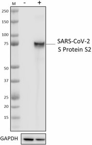 Purified anti-SARS-CoV S Protein S2 Antibody (944301)