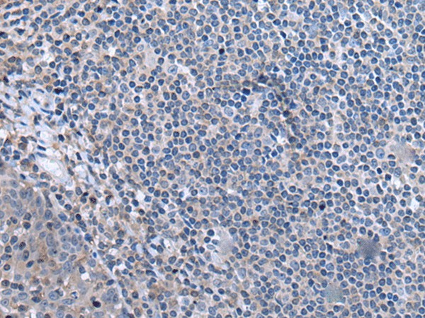 CCK Polyclonal Antibody (E-AB-52139)