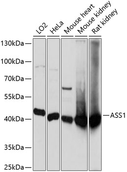 ASS1 Polyclonal Antibody (E-AB-65392)
