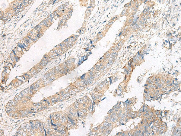 FERD3L Polyclonal Antibody (E-AB-17959)
