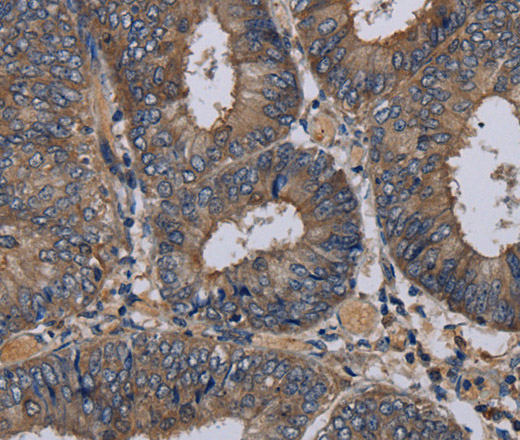 NECTIN3 Polyclonal Antibody (E-AB-11439)