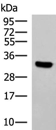 KCTD7 Polyclonal Antibody (E-AB-18176)