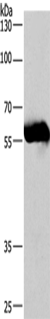 CORO1C Polyclonal Antibody (E-AB-14887)