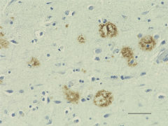 Biotin anti-β-Amyloid, 17-24 Antibody (Previously Covance catalog# SIG-39240) (800704)
