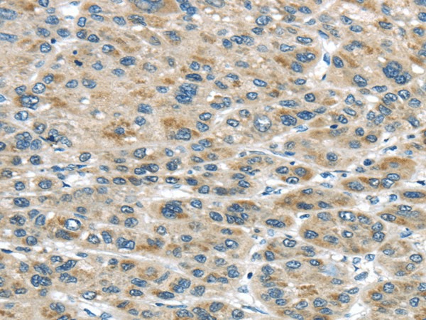 TRAIP Polyclonal Antibody (E-AB-17153)