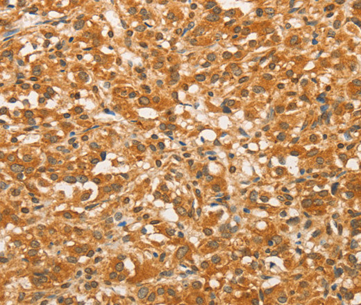 BCL2L14 Polyclonal Antibody (E-AB-14641)