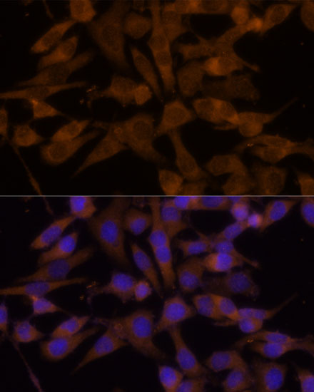 UGT2B7 Polyclonal Antibody (E-AB-66991)