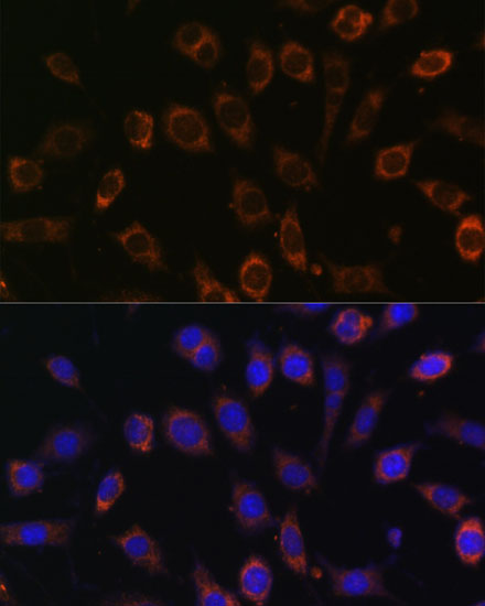TCIRG1 Polyclonal Antibody (E-AB-65293)