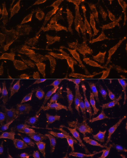 TNFRSF11A Polyclonal Antibody (E-AB-65990)