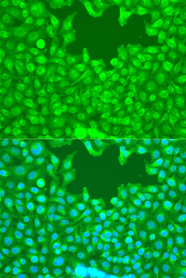 TAZ Polyclonal Antibody (E-AB-66586)