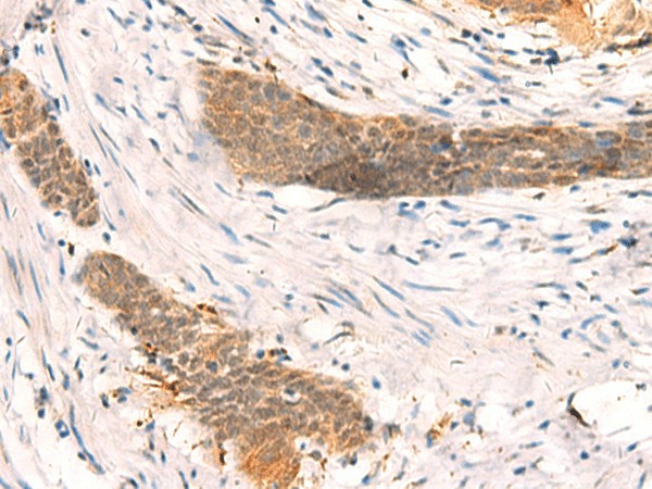 SETD1A Polyclonal Antibody (E-AB-52002)