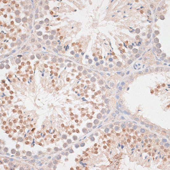 MAD2L1 Polyclonal Antibody (E-AB-66796)