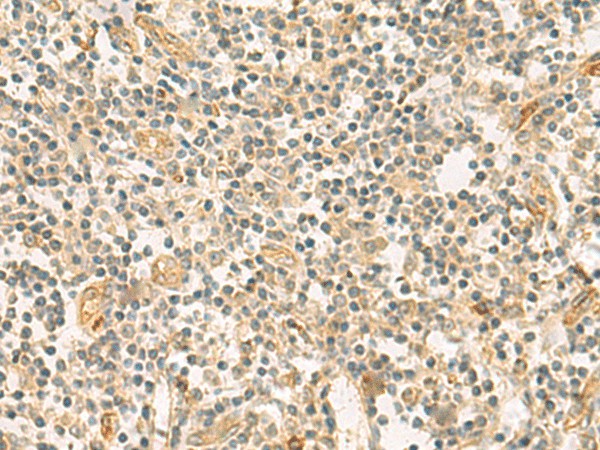 HHIPL2 Polyclonal Antibody (E-AB-19201)