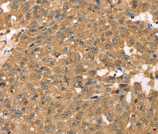 RPLP2 Polyclonal Antibody (E-AB-15364)