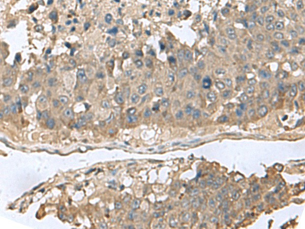 GABARAPL2 Polyclonal Antibody (E-AB-53021)