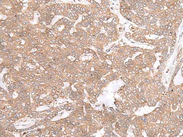 PTP4A3 Polyclonal Antibody (E-AB-18775)