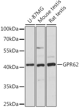 GPR62 Polyclonal Antibody (E-AB-66707)