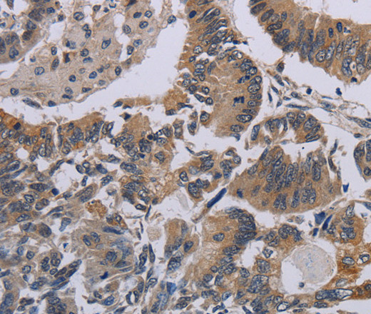 CCL1 Polyclonal Antibody (E-AB-13457)