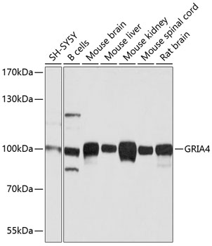 GRIA4 Polyclonal Antibody (E-AB-62775)