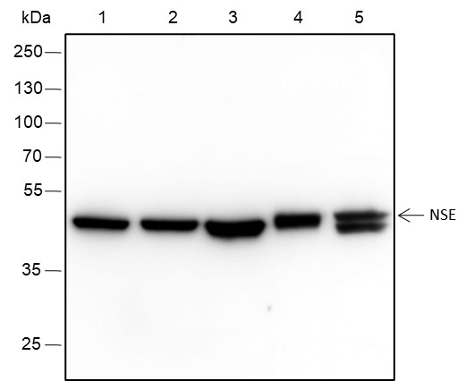 Recombinant NSE Monoclonal Antibody (AN301611L)
