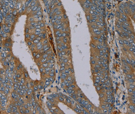 PYY Polyclonal Antibody (E-AB-16699)