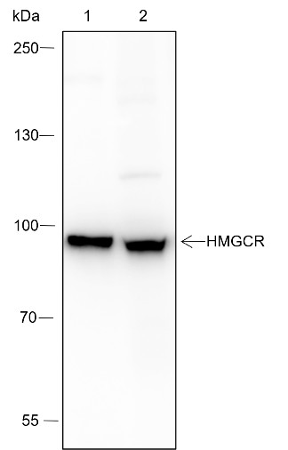 Recombinant HMGCR Monoclonal Antibody (AN301555L)