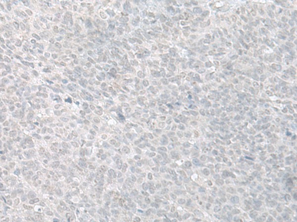 C8orf4 Polyclonal Antibody (E-AB-52679)