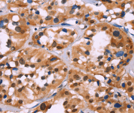 HIST1H1C Polyclonal Antibody (E-AB-10364)