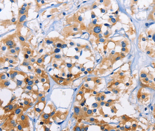CAPZA3 Polyclonal Antibody (E-AB-11030)