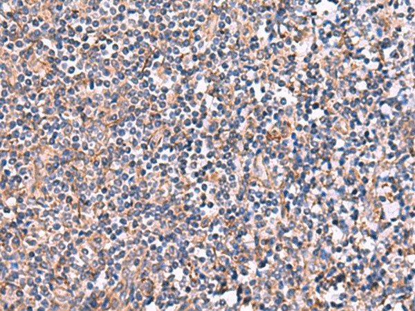 INPP5B Polyclonal Antibody (E-AB-18115)