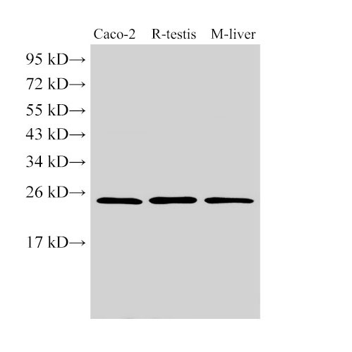 GSTA1 Polyclonal Antibody (D-AB-10164L)