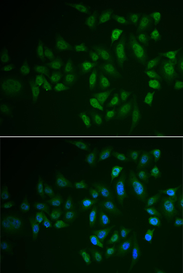 MYLK3 Polyclonal Antibody (E-AB-61282)