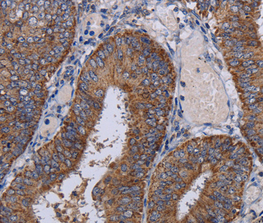 NDUFA1 Polyclonal Antibody (E-AB-11424)