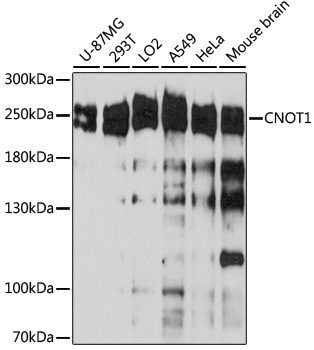 CNOT1 Polyclonal Antibody (E-AB-92695)