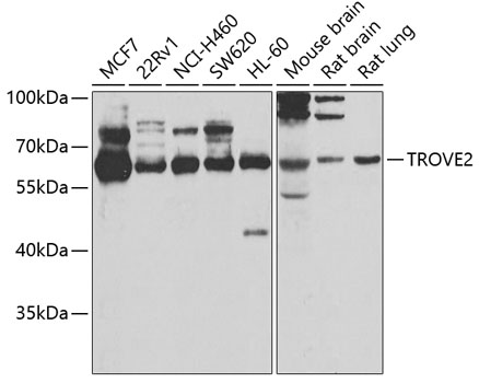 TROVE2 Polyclonal Antibody (E-AB-67807)