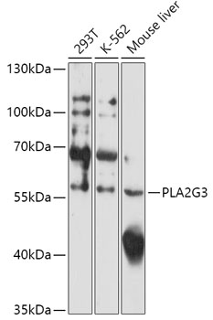 PLA2G3 Polyclonal Antibody (E-AB-91870)