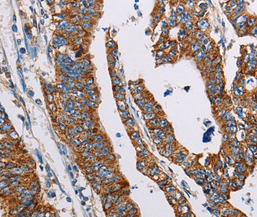 ALG2 Polyclonal Antibody (E-AB-14541)
