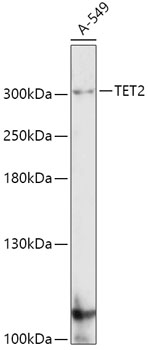 TET2 Polyclonal Antibody (E-AB-61060)