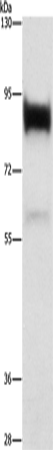 LTF Polyclonal Antibody (E-AB-10908)