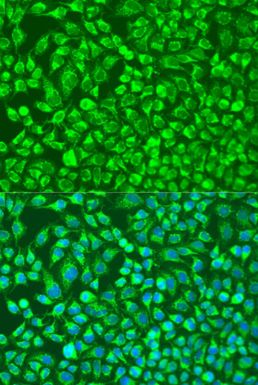 MMP14 Polyclonal Antibody (E-AB-66536)